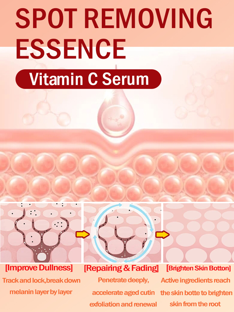 Lighten Freckles Melasma, Faci - đánh giá và giá Ultra Luxury Skincare
